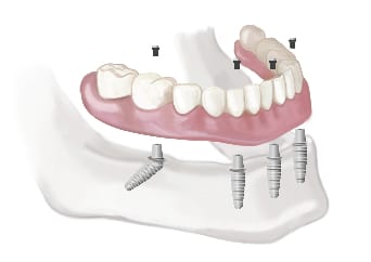 snap1609