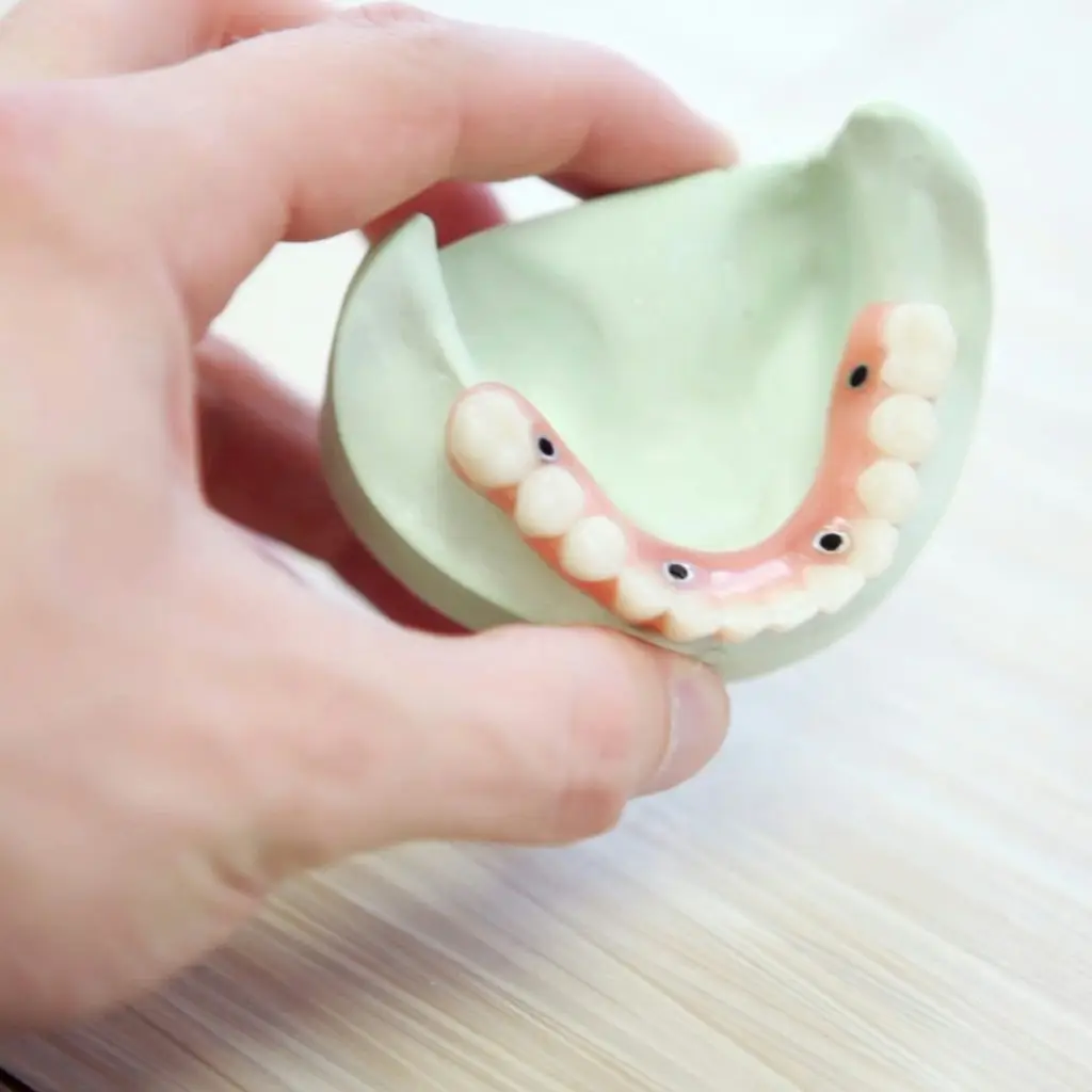 Dental Implants Sidcup