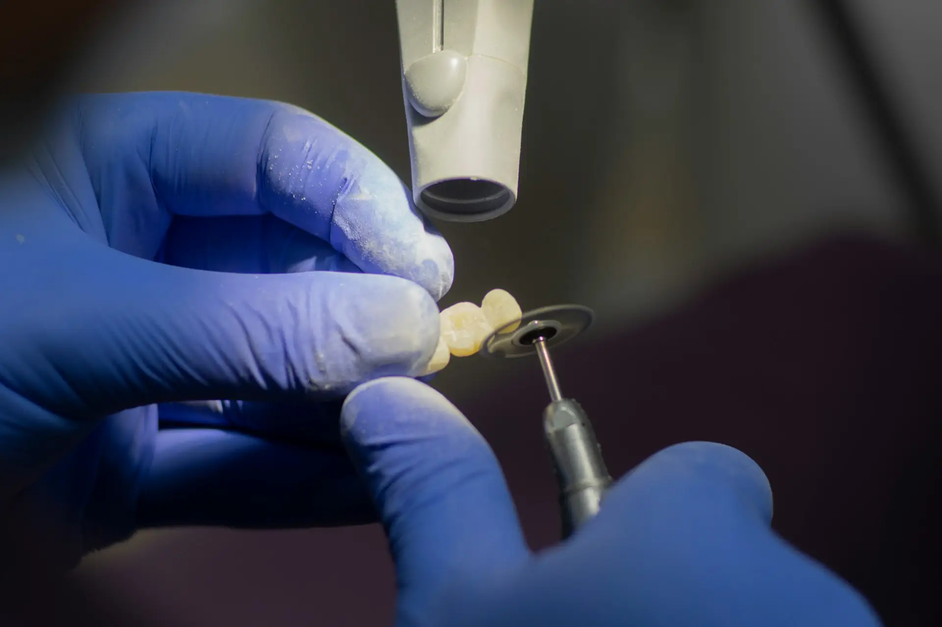 Dental Bridges