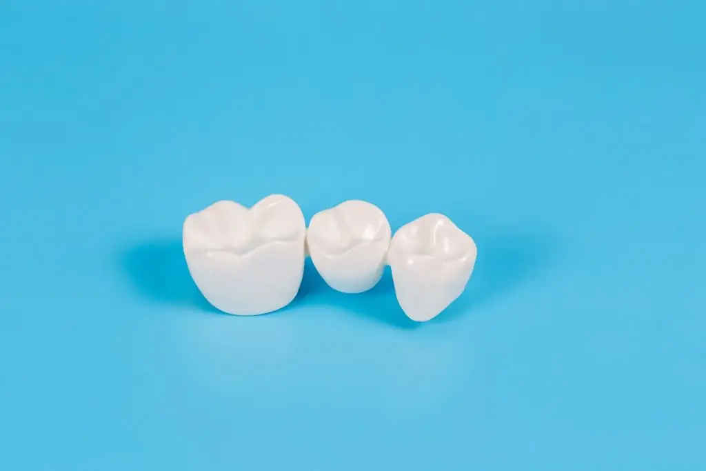 Dental bridges Sidcup